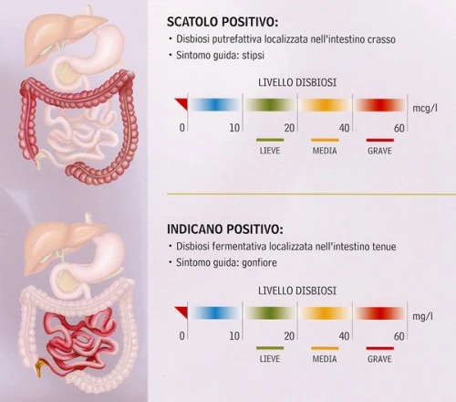 Test Disbiosi Intestinale : (Rivoli)